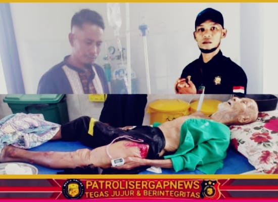 Lansia Korban Tabrak Lari di Peudada, Alami Patah Tulang dan Dirawat di RSU dr. Fauziah Bireuen